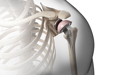 Wi Ortho Shoulder Specialist