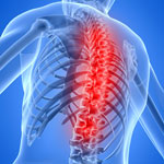 back pain and low back pain treated in Rhode Island