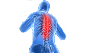back pain, low back pain, sciatica