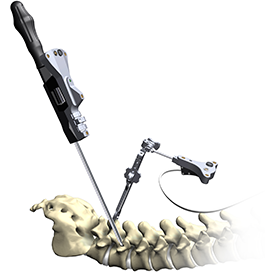spine navigation technology for spine surgery in rhode island, 3d imaging used by spine surgeons during surgery
